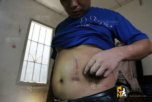 �������� ���ú��ݷǷ��������ѳ���